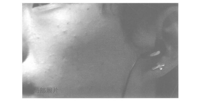顴骨的素描畫(huà)法